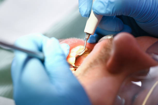 Best Broken or Cracked Tooth Emergency Dentist in Enochville, NC